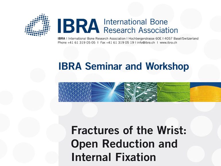 Fractures of the Wrist: Open Reduction and Internal Fixation poster