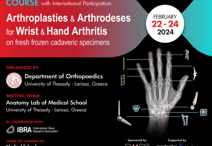 Arthroplasties & Arthrodeses for wrist and hands arthritis